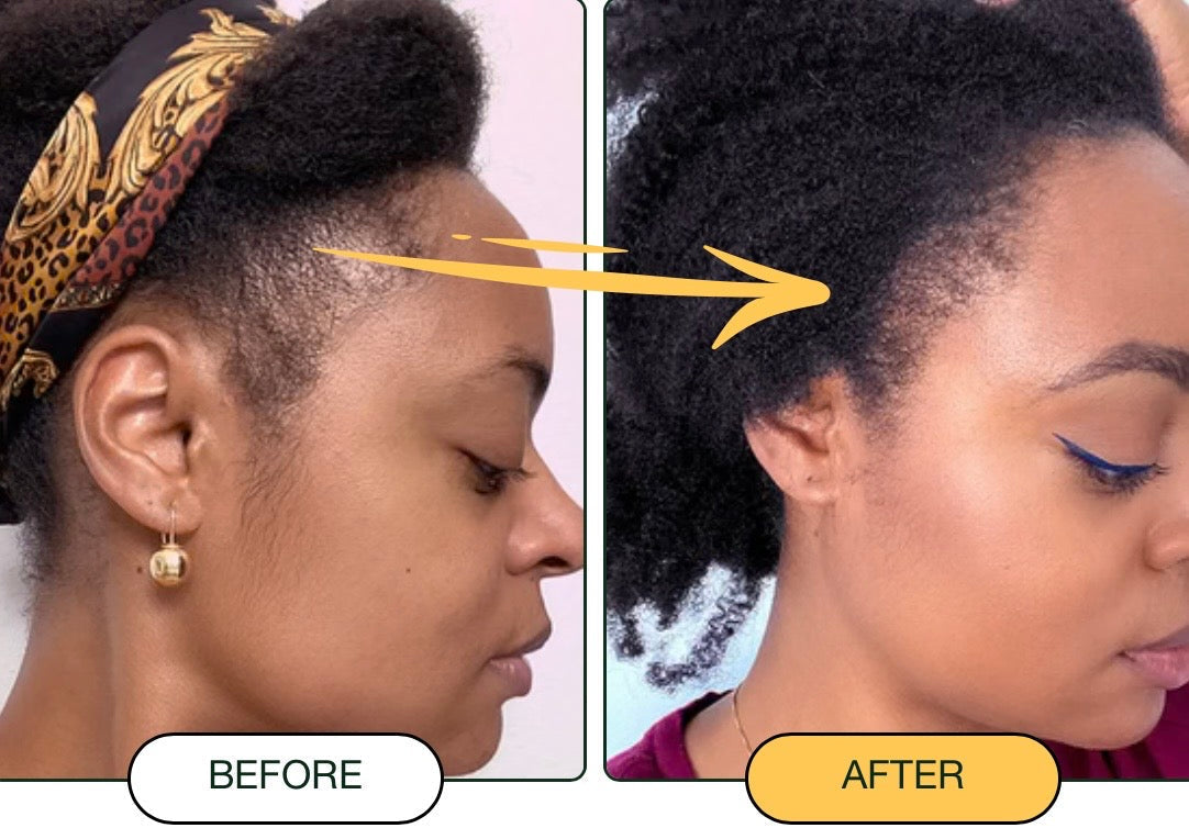 Racines Nourries, Cheveux Plus Denses – Huile de Batana