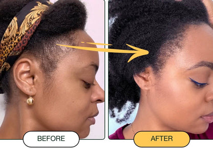 Racines Nourries, Cheveux Plus Denses – Huile de Batana