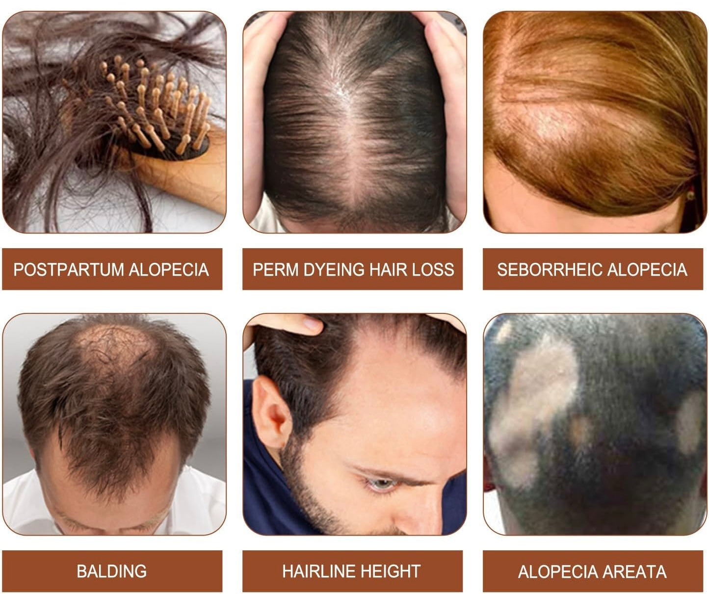 Racines Nourries, Cheveux Plus Denses – Huile de Batana