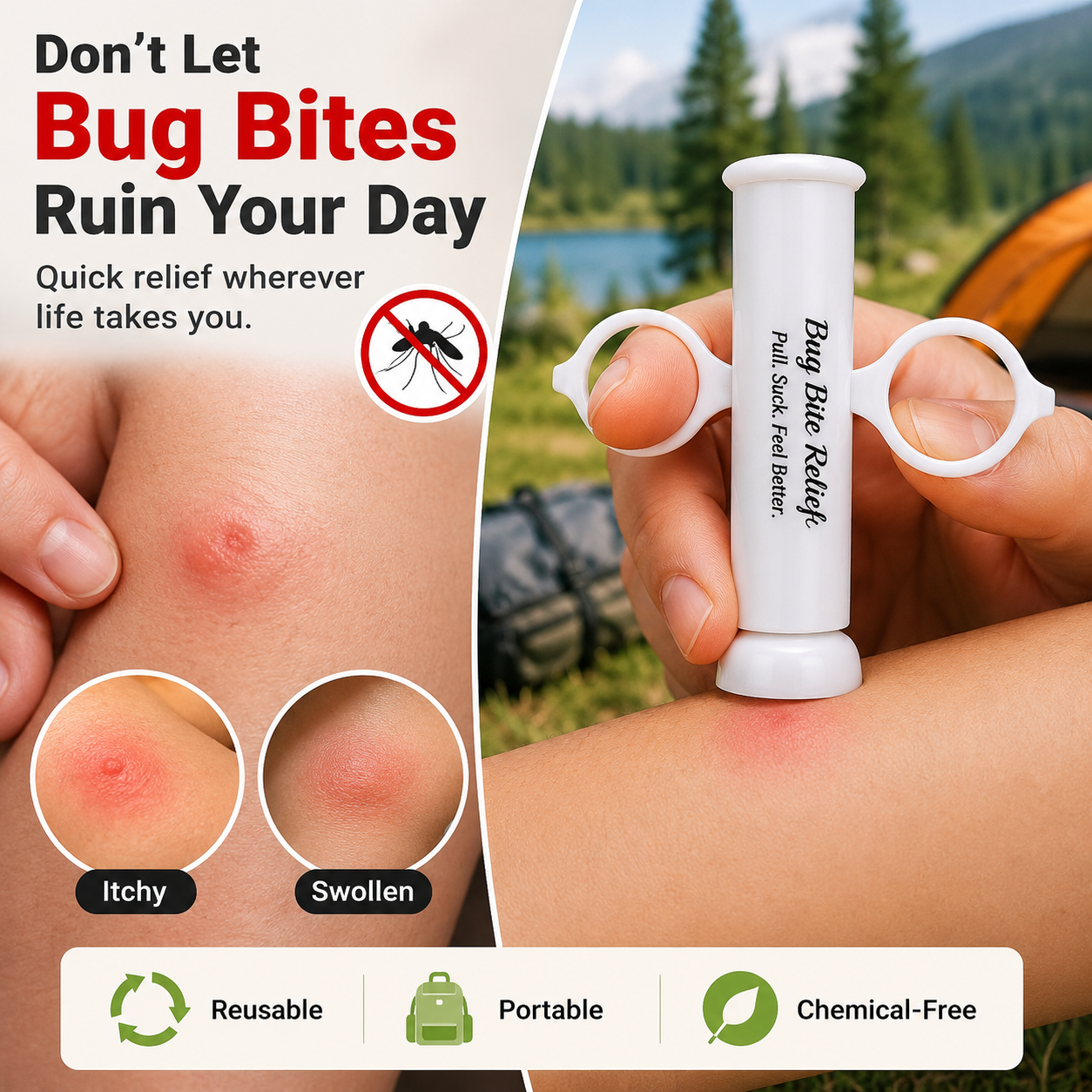 Bug Bite Thing Suction Tool,Poison Remover - Stop Mosquito Bite Itch In Seconds